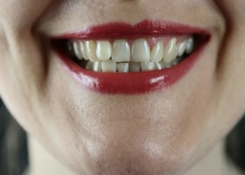 لايف ستايلتطوير عقار هو الأول من نوعه يساعد على انبات أسنان جديدة