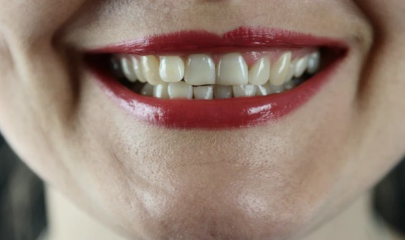 لايف ستايلتناول الفواكه الغنية بالكالسيوم والألياف يساعد على تقوية الأسنان الضعيفة