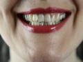 لايف ستايلنصائح لتخفيف حساسية الأسنان